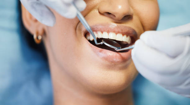 Best Emergency Broken Tooth Repair in Hudson, NY